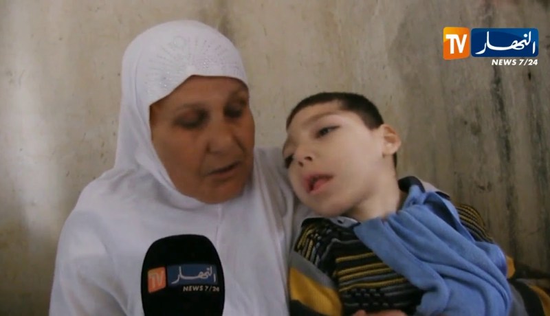 قالمة: محمد أمين..طفل ولد بمرض غريب تناشد عائلته السلطات للتكفل به