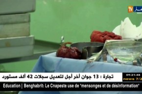 بسكرة/ 60 عملية جراحية نوعية في الأيام الطبية الجراحية