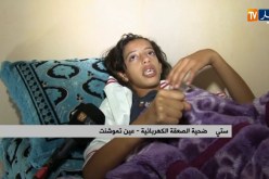 عين تموشنت/ إخنلاط الماء والكهرباء بعمارة يتسبب بصعقة كهربائية لطفلة