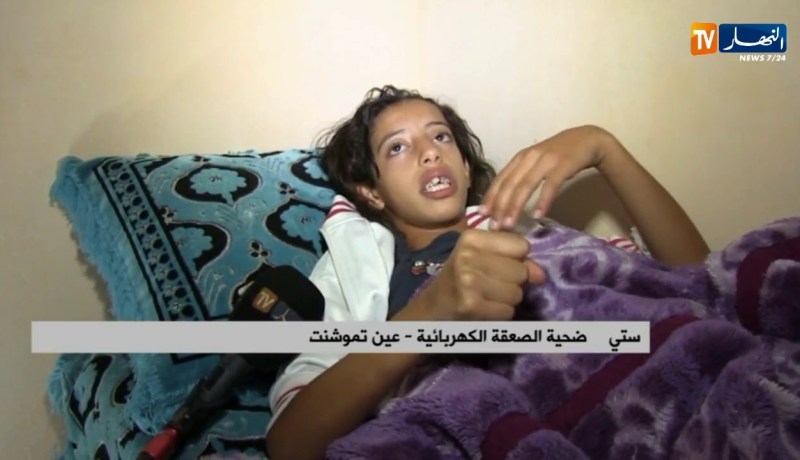 عين تموشنت/ إخنلاط الماء والكهرباء بعمارة يتسبب بصعقة كهربائية لطفلة