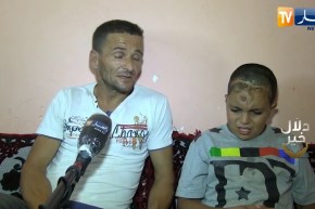 دلال خير: 7 عمليات جراحية لم تفلح في علاج طفل سقط من علو كبير وعائلته تطلب من السلطات مساعدته