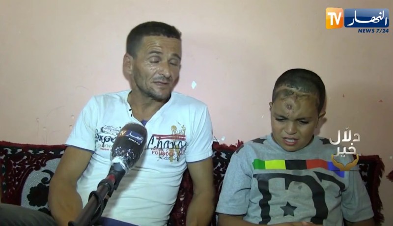 دلال خير: 7 عمليات جراحية لم تفلح في علاج طفل سقط من علو كبير وعائلته تطلب من السلطات مساعدته