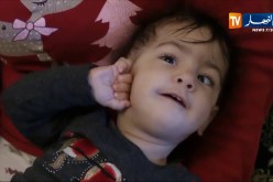 معسكر: زهرة.. طفلة مصابة بشلل تستنجد بالمحسنين لإجراء عملية جراحية في تركيا