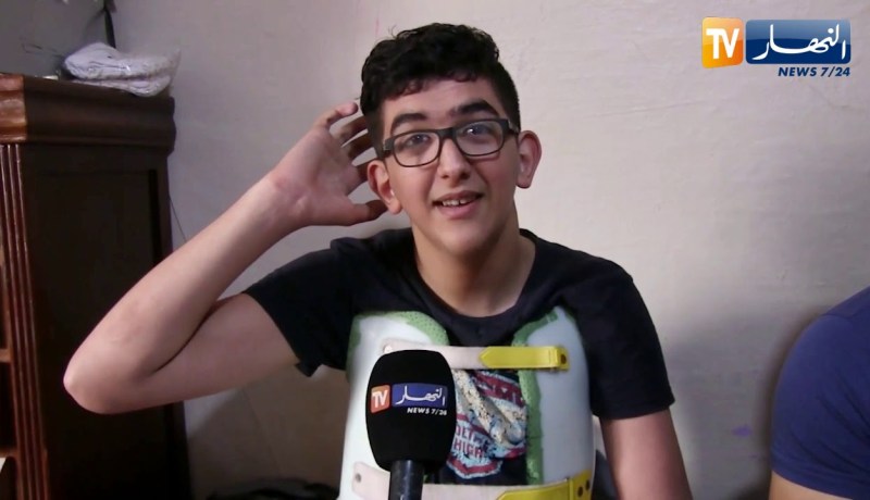 بجاية: مرض نادر يسارع من نمو غير طبيعي للطفل فؤاد صاحب 12 عام