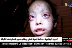 عين الدفلى: رميسة.. براءة عاشت طفولة كلها ألم بسب مرض جلدي علاجه مرهم..