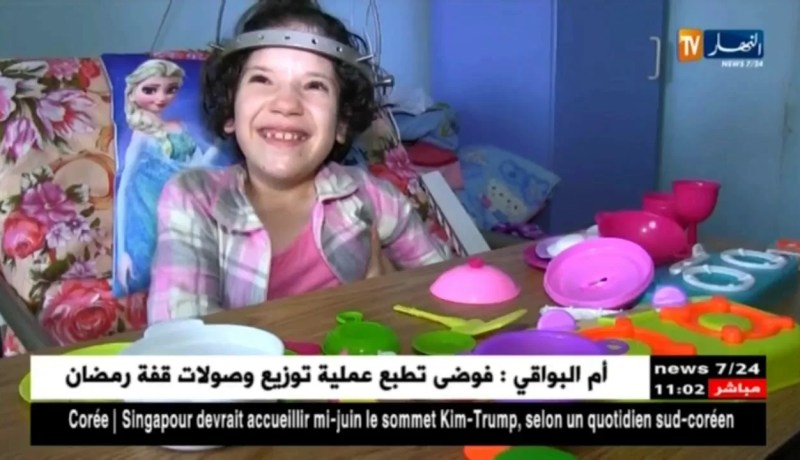 عين تموشنت: عمليات جراحية مستعصية تجرى بمستشفى بن زرجب