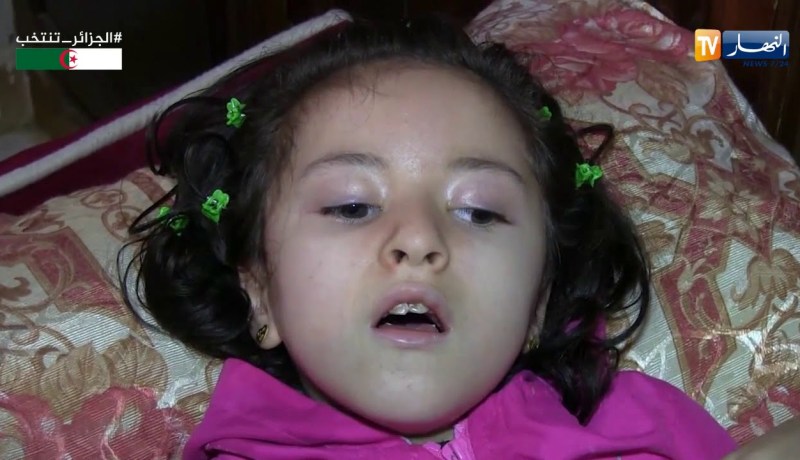 بجاية/ عائلة دنيا تناشد وزارة الصحة لإنقاذ حياتها بعد إصابتها بمرض نادر