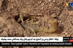 صحة: هذه هي الخطوات الواجب إتباعها أثناء التعرض للسعات العقارب