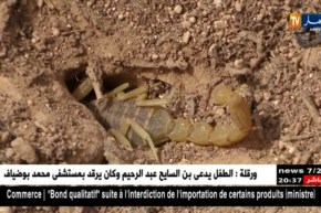 صحة: هذه هي الخطوات الواجب إتباعها أثناء التعرض للسعات العقارب