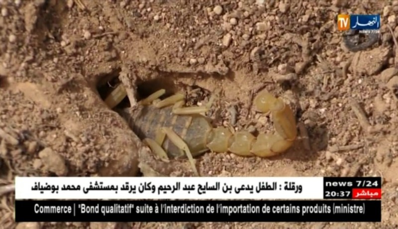 صحة: هذه هي الخطوات الواجب إتباعها أثناء التعرض للسعات العقارب