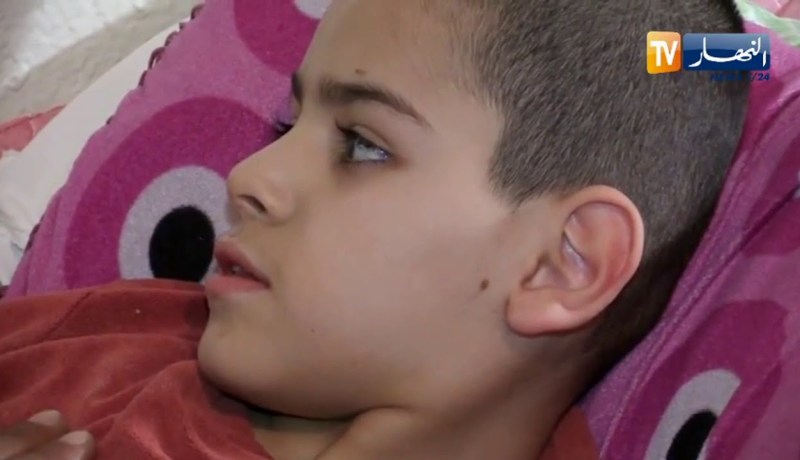 باتنة: عبد الحق سباقي .. براءة تعاني بسبب مرض “الصرع”