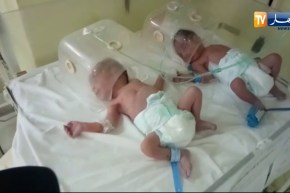 ميلاد أربع توائم بمستشفى سيدي بلعباس