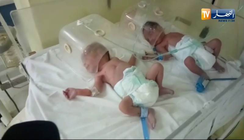 ميلاد أربع توائم بمستشفى سيدي بلعباس