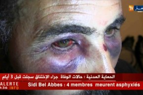 عاهات مستديمة ونفسيات منهارة.. العنف اللفظي والجسدي يحوّل المدارس إلى جحيم