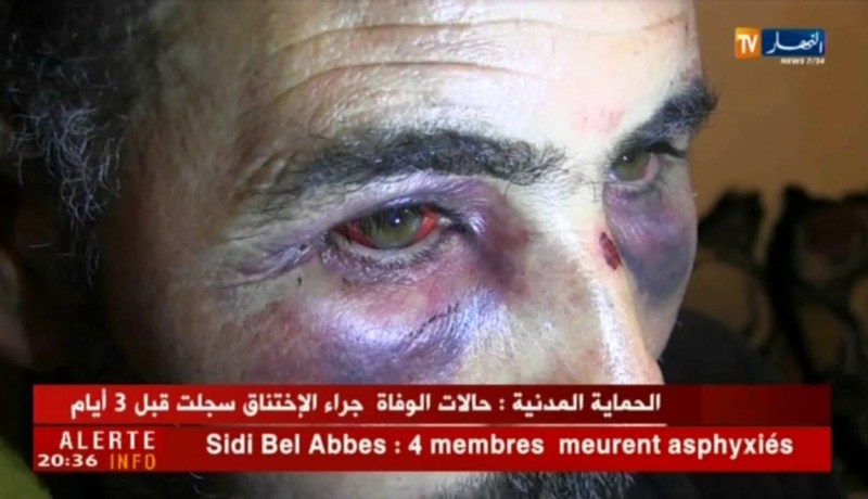 عاهات مستديمة ونفسيات منهارة.. العنف اللفظي والجسدي يحوّل المدارس إلى جحيم