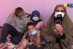 خنشلة : الطفلة تعاني بسبب إصابتها بحروق من الدرجة الثالثةِ