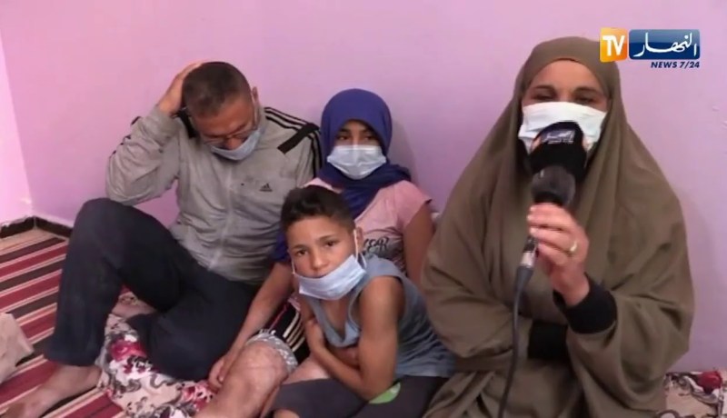 خنشلة : الطفلة تعاني بسبب إصابتها بحروق من الدرجة الثالثةِ