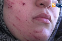 سطيف: القصة الكاملة للإعتداء على طالبة جامعية بشفرة حلاقة في إقامة الهضاب 06
