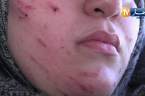 سطيف: القصة الكاملة للإعتداء على طالبة جامعية بشفرة حلاقة في إقامة الهضاب 06