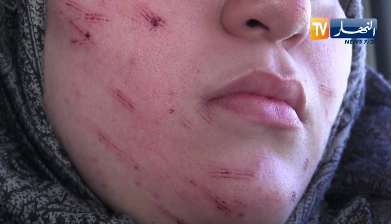 سطيف: القصة الكاملة للإعتداء على طالبة جامعية بشفرة حلاقة في إقامة الهضاب 06