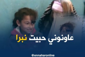 غليزان/ “ليلى” تعاني من تشوه خلقي تناشد المحسنين لمساعدتها في عملية جراحية