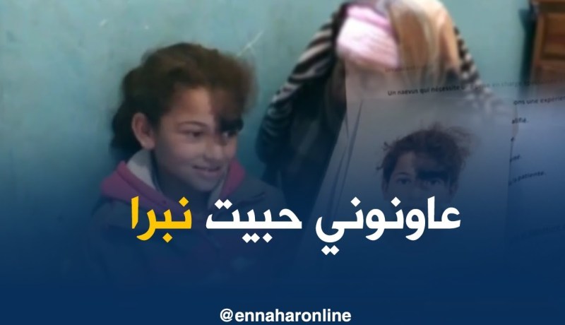 غليزان/ “ليلى” تعاني من تشوه خلقي تناشد المحسنين لمساعدتها في عملية جراحية