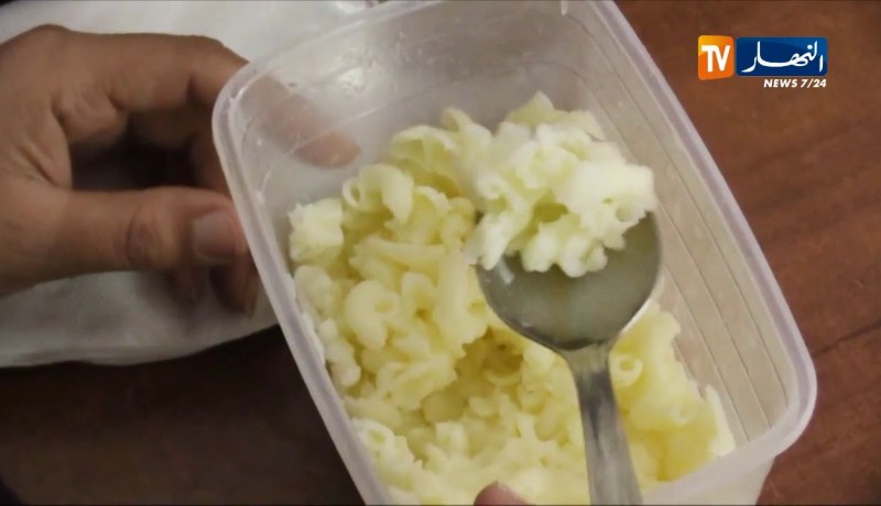 صحة: آمال ..حكاية 36 سنة من تحدي مرض السيلياك