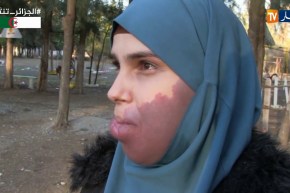 أم البواقي/ شباب يطلق حملة تضامنية لمساعدة إيمان وذكرى من بلدية مسكيانة