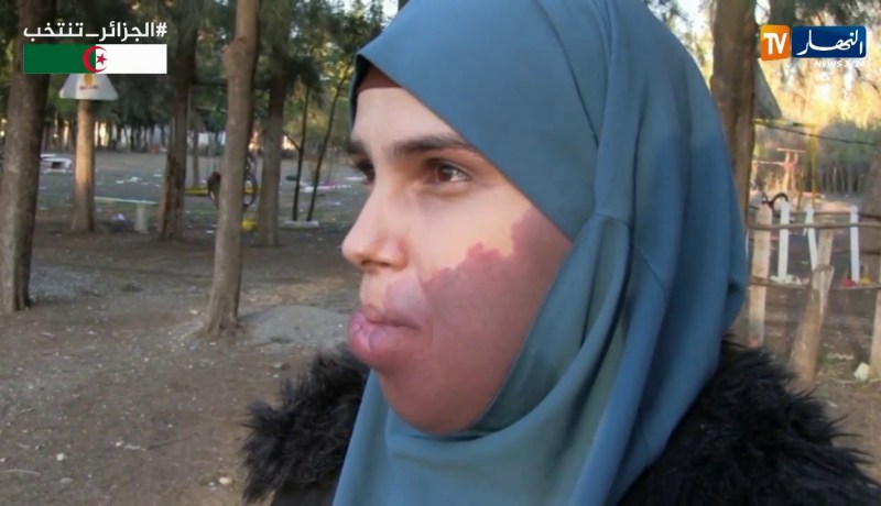 أم البواقي/ شباب يطلق حملة تضامنية لمساعدة إيمان وذكرى من بلدية مسكيانة