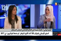 “تومو تيرابي”…تقنية جديدة في العلاج الإشعاعي لمرضى السرطان