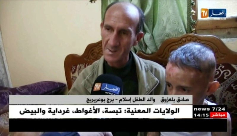 برج بوعريريج: إسلام .. مصاب بمرض جلدي نادر و يأمل بالشفاء