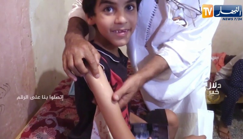 دلال خير: طفلان مصابان بمرض نادر عجز الأطباء عن علاجهما يرجوان مساعدة المحسنين للعلاج في الخارج