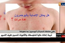 64 حالة بولاية إيليزي …تسجيل حالات الحصبة في الجزائر بعد سنوات من الغياب !