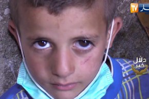 دلال خير: إسلام ومنذر شقيقان يعانيان من مرض نادر في البصر