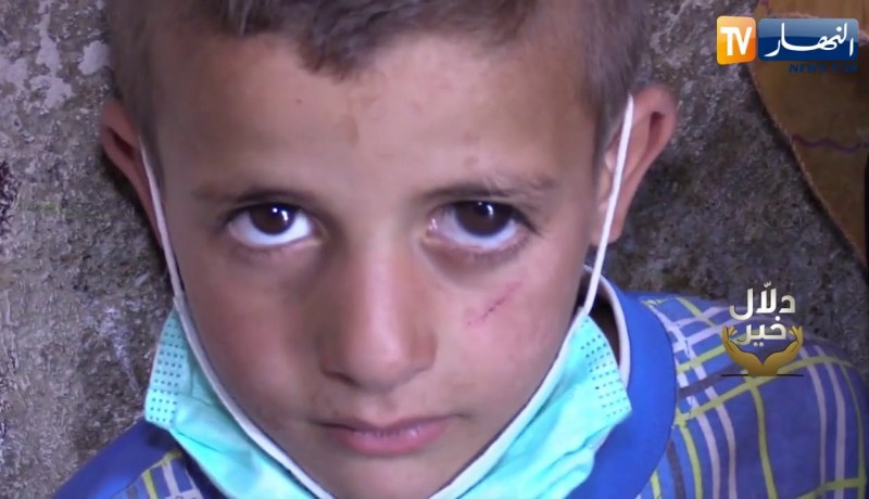 دلال خير: إسلام ومنذر شقيقان يعانيان من مرض نادر في البصر