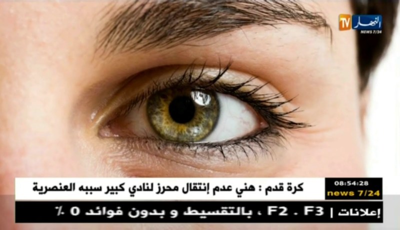 صحة ونصيحة: الفحوصات الدورية خير سبيل للوقاية من زرق العين