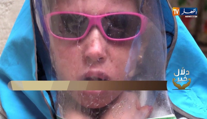 دلال خير: شقيقتان من أطفال القمر تعانيان في صمت وعالتهما تطالب السلطات لمساعدتهم في العلاج