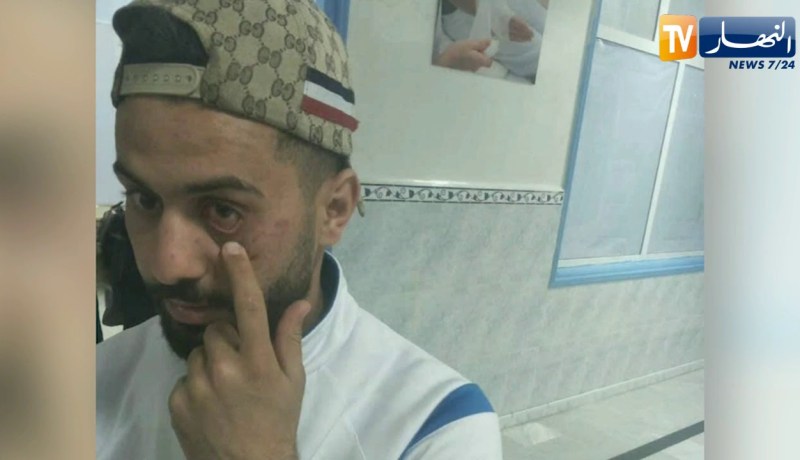 أبشع الصور والبقاء للأعنف.. كرة القدم في الأقسام الدنيا إلى أين ؟