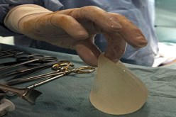 أطباء مكسيكيون يحذرون من استخدام أنسجة ثدي صناعية