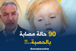المدير الولائي للصحّة بالوادي: “عدد الحالات المصابة بداء الحصبة منذ البارحة قدّرت بـ 90 حالة..!!”