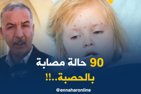 المدير الولائي للصحّة بالوادي: “عدد الحالات المصابة بداء الحصبة منذ البارحة قدّرت بـ 90 حالة..!!”