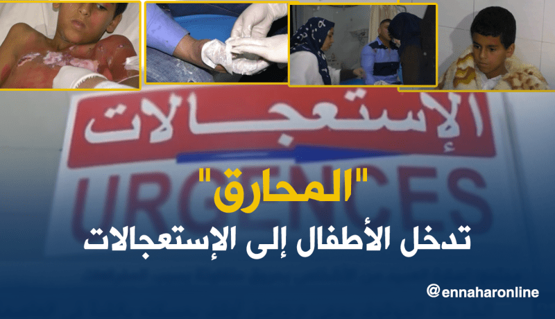 حروق من الدرجة الثالثة والسبب “المحارق”