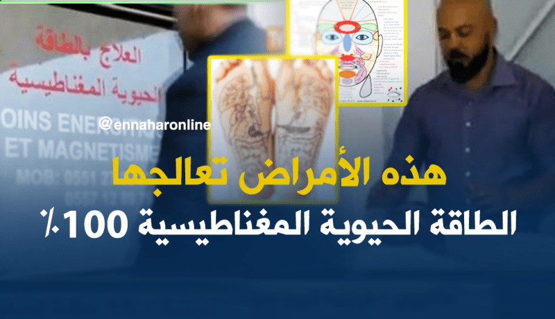 الطاقة الحيوية المغناطيسية ..طريقة جديدة للعلاج في الجزائر