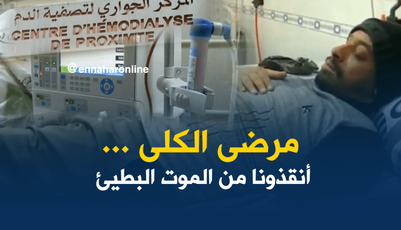 بالفيديو…4 آلاف جزائري يعانون من القصور الكلوي
