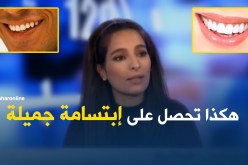 للحصول على إبتسامة جميلة.. الأساليب الصحية والصحيحة 