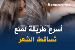 تساقط الشعر.. أسبابه وطرق علاجه