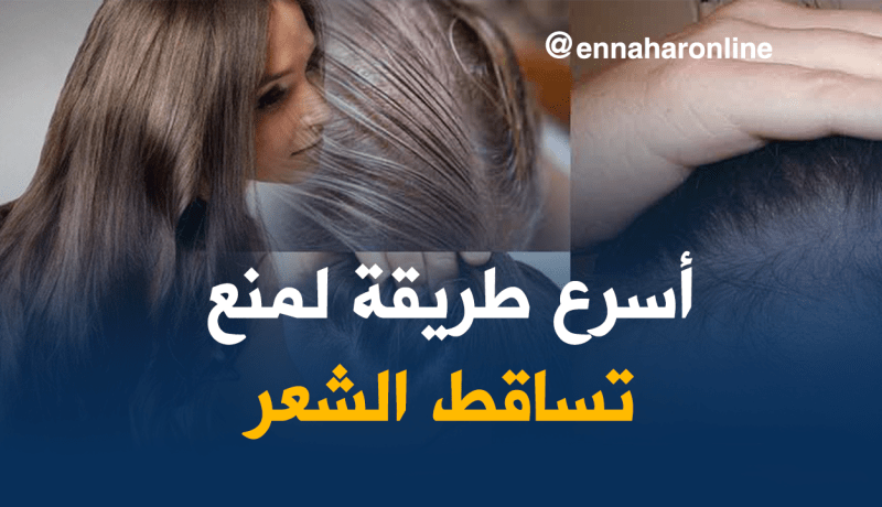تساقط الشعر.. أسبابه وطرق علاجه