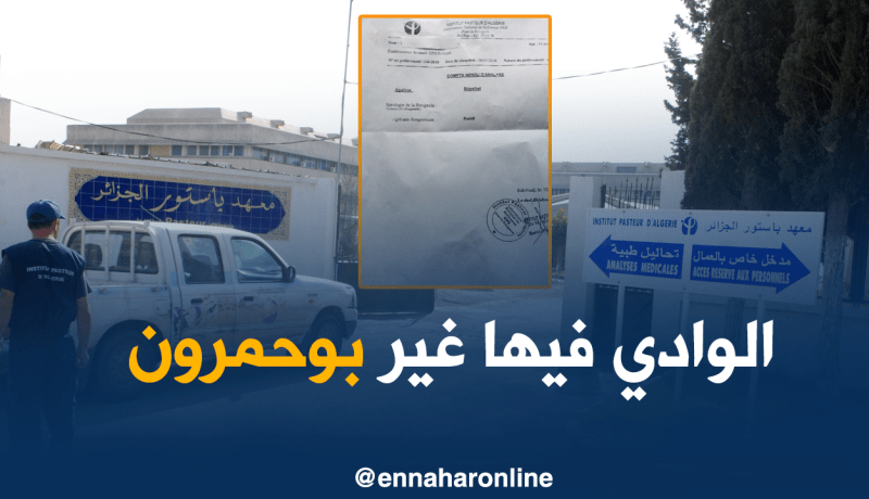 باستور: لاوجود لأي وباء ماعدا البوحمرون بالوادي
