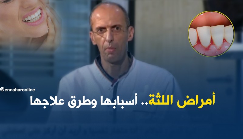 بالفيديو.. أمراض اللثة أسبابها وطرق علاجها