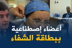 الإستفادة من الأعضاء الإصطناعية عن طريق بطاقة الشّفاء بداية 2018